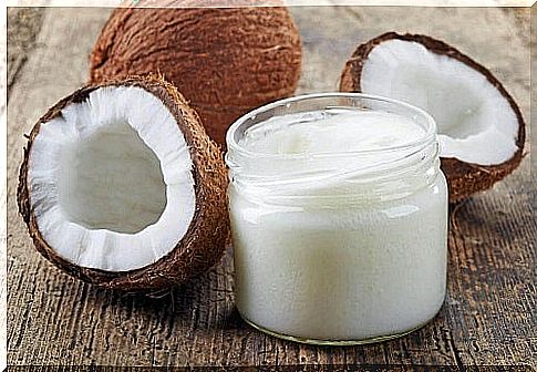 Coconut oil on the list of natural remedies for scalp psoriasis 