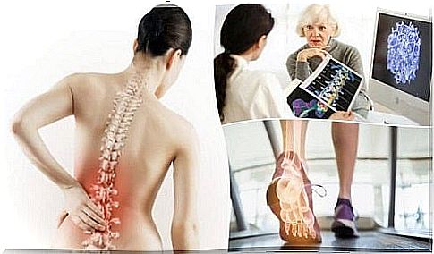 6 essential information about osteoporosis