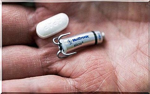 Micra pacemaker - the smallest in the world