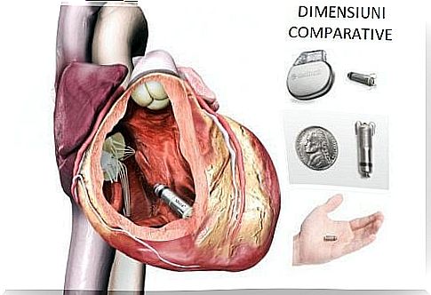 The Micra pacemaker is the size of a 1 euro coin