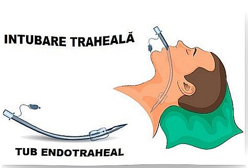 Instructions for use of different types of endotracheal tubes